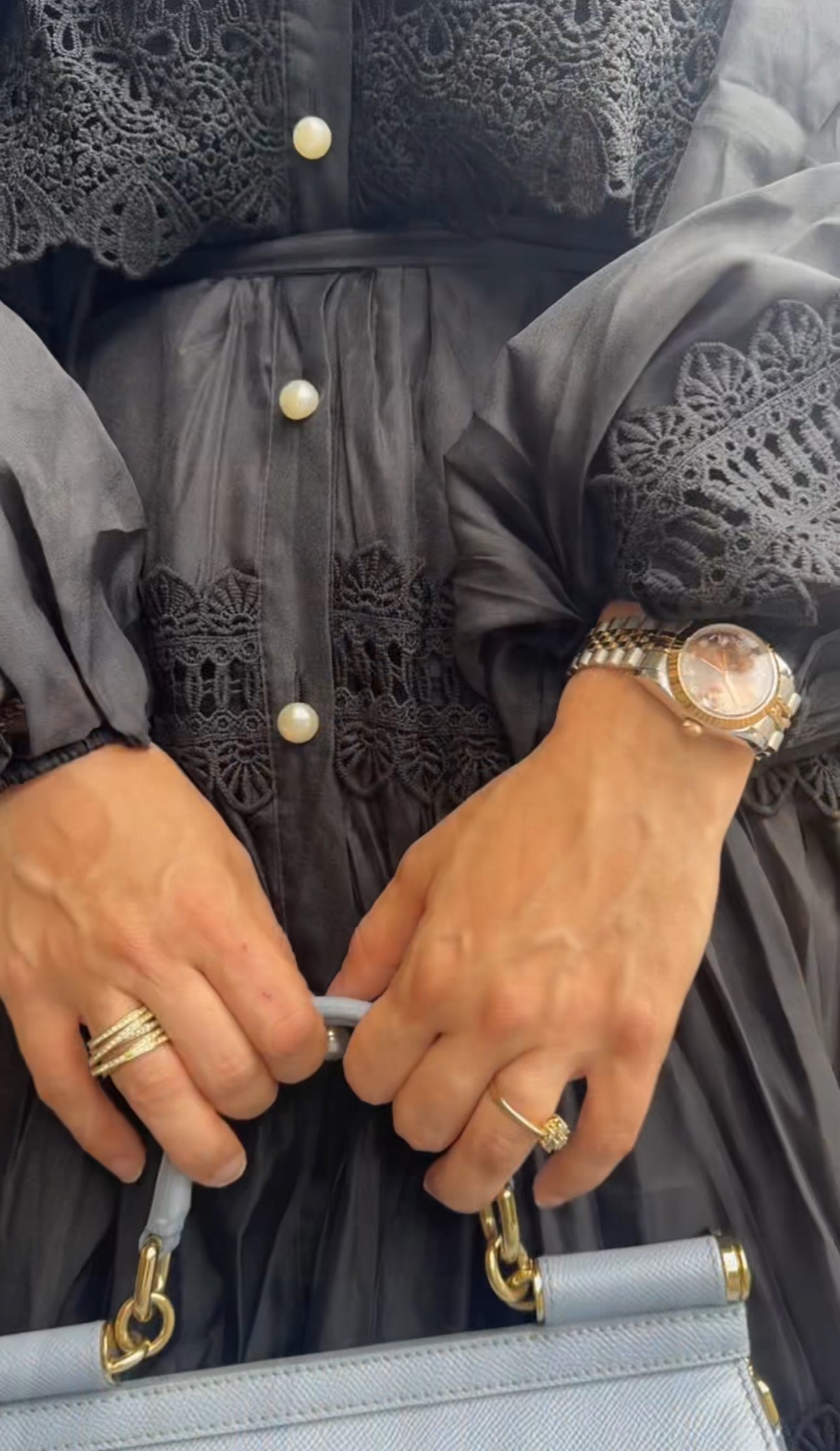 Black Zimmerman Lace Dress